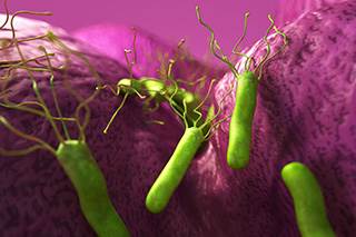 H Pylori drawing